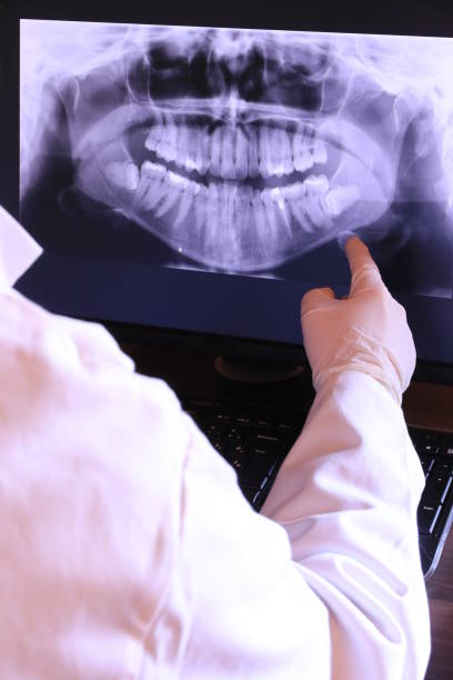 Best Dental Abscess Treatment in Manchester, MO